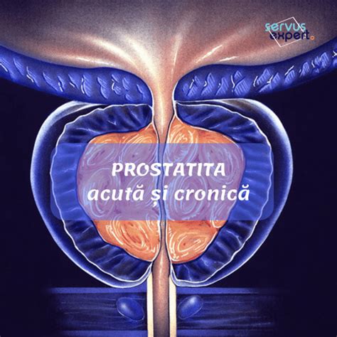 inflamația hr. prostatita